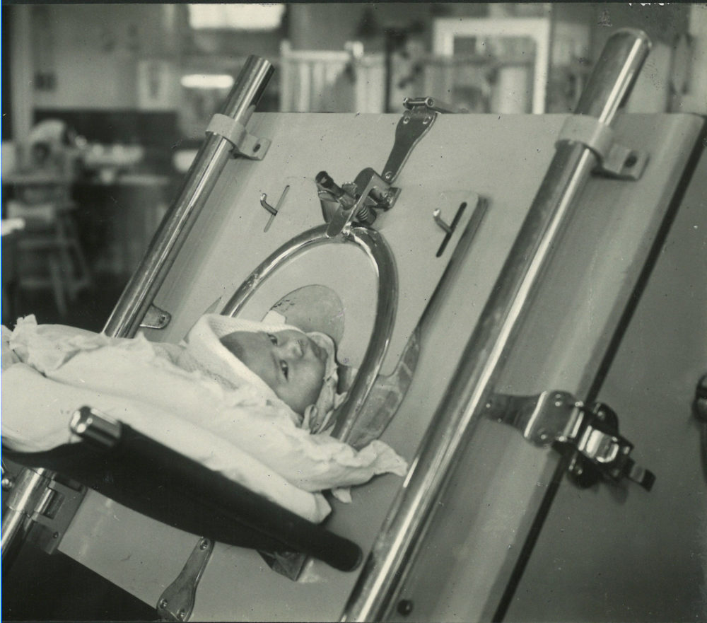 Infant in iron lung, 1940s